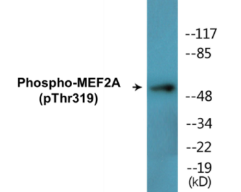 Western blot analysis of extracts from K562 cells treated with UV 15', using MEF2A (Phospho-Thr319) Antibody.