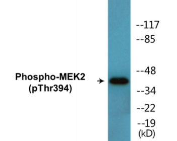 Western blot analysis of extracts from ovary cancer, using MEK2 (Phospho-Thr394) Antibody.