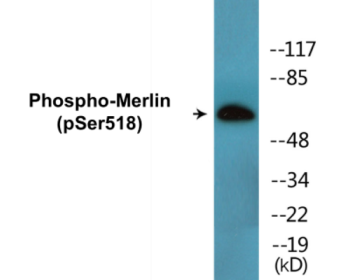 Western blot analysis of extracts from HuvEc cells treated with IFN-alpha 1000U/ml 18h, using Merlin (Phospho-Ser518) Antibody.