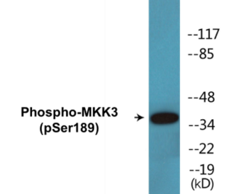 Western blot analysis of extracts from MDA-MB-435 cells, using MKK3 (Phospho-Ser189) Antibody.