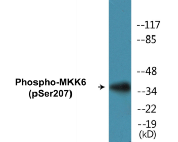 Western blot analysis of extracts from MDA-MB-435 cells, using MKK6 (Phospho-Ser207) Antibody.