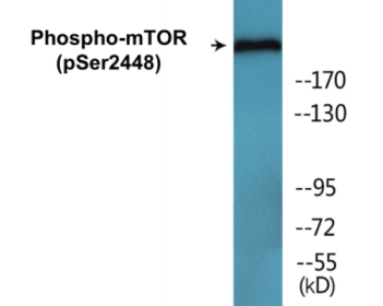 Western blot analysis of extracts from HeLa cells treated with EGF 200ng/ml 30', using mTOR (Phospho-Ser2448) Antibody.