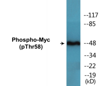Western blot analysis of extracts from ovary cancer, using Myc (Phospho-Thr58) Antibody.