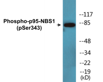 Western blot analysis of extracts from Jurkat cells, using p95/NBS1 (Phospho-Ser343) Antibody.