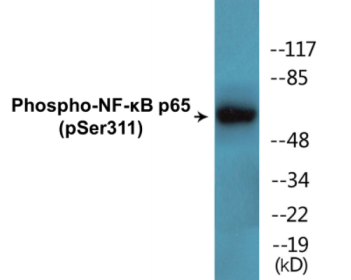 Western blot analysis of extracts from LOVO cells treated, using NF-kappaB p65 (Phospho-Ser311) Antibody.