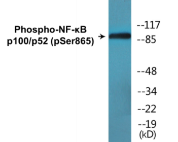 Western blot analysis of extracts from ovary cancer, using NF-kappaB p100/p52 (Phospho-Ser865) Antibody.