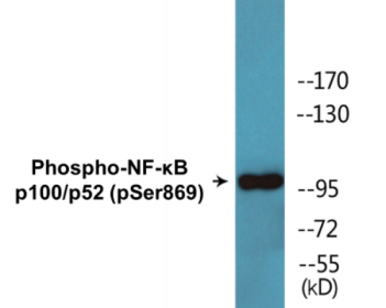 Western blot analysis of extracts from MDA-MB-435 cells treated with TNF-alpha, using NF-kappaB p100/p52 (Phospho-Ser869) Antibody.