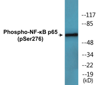Western blot analysis of extracts from Jurkat cells, using NF-kappaB p65 (Phospho-Ser276) Antibody.