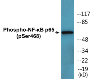 Western blot analysis of extracts from Jurkat cells and 293 cells, using NF-kappaB p65 (Phospho-Ser468) Antibody.