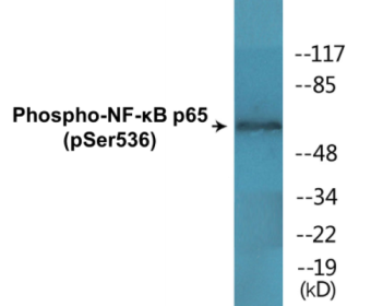 Western blot analysis of extracts from K562 cells and COLO cells, using NF-kappaB p65 (Phospho-Ser536) Antibody.