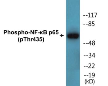 Western blot analysis of extracts from COS7 cells treated with TNF-alpha, using NF-kappaB p65 (Phospho-Thr435) Antibody.
