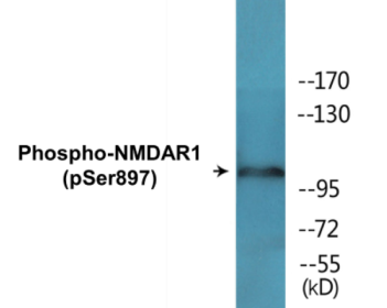 Western blot analysis of extracts from LOVO cells, using NMDAR1 (Phospho-Ser897) Antibody.