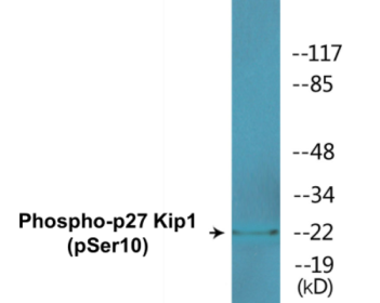 Western blot analysis of extracts from A2780 and COLO205 cells, using p27 Kip1 (Phospho-Ser10) Antibody.
