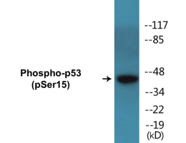 Western blot analysis of extracts from HeLa cells treated with HU, using p53 (Phospho-Ser15) Antibody.