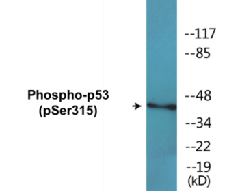 Western blot analysis of extracts from ovary cancer, using p53 (Phospho-Ser315) Antibody.