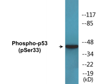 Western blot analysis of extracts from 293 cells treated with UV, using p53 (Phospho-Ser33) Antibody.