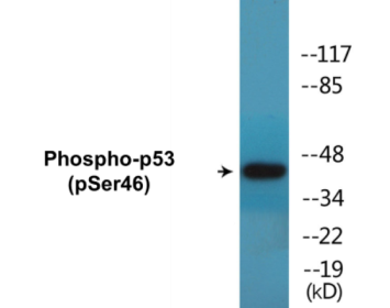 Western blot analysis of extracts from 293 cells treated with UV, using p53 (Phospho-Ser46) Antibody.