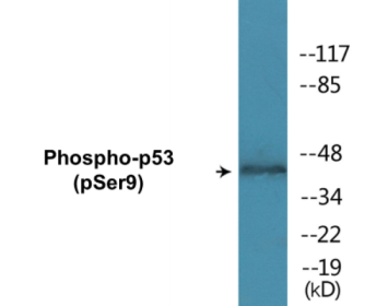Western blot analysis of extracts from LOVO cells, using p53 (Phospho-Ser9) Antibody.