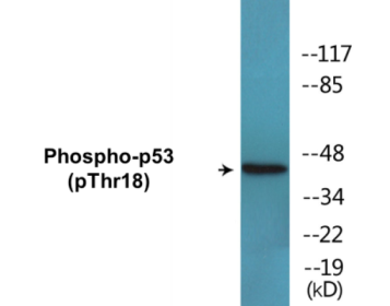 Western blot analysis of extracts from Ovary cancer and K562 cells, using p53 (Phospho-Thr18) Antibody.