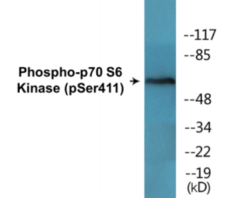 Western blot analysis of extracts from K562 cells, NIH/3T3 cells and COLO205 cells, using p70 S6 Kinase (Phospho-Ser411) Antibody.