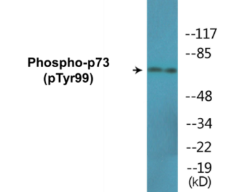 Western blot analysis of extracts from K562 cells treated with Pervanadate, using p73 (Phospho-Tyr99) Antibody.
