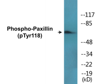 Western blot analysis of extracts from HeLa cells treated with EGF, using Paxillin (Phospho-Tyr118) Antibody.