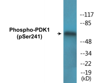 Western blot analysis of extracts from HeLa cells and NIH/3T3 cells, using PDK1 (Phospho-Ser241) Antibody.