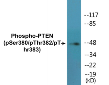 Western blot analysis of extracts from HT29 cells treated with Calycalin A, using PTEN (Phospho-Ser380/Thr382/Thr383) Antibody.