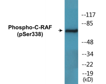 Western blot analysis of extracts from HeLa cells treated with paclitaxel 1uM 24h, using C-RAF (Phospho-Ser338) Antibody.