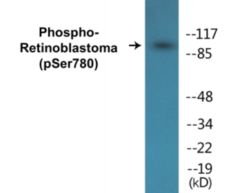 Western blot analysis of extracts from K562 cells treated with serum 10%, using Retinoblastoma (Phospho-Ser780) Antibody.