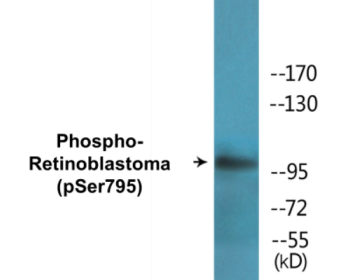 Western blot analysis of extracts from K562 cells treated with serum 10%, using Retinoblastoma (Phospho-Ser795) Antibody.