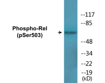 Western blot analysis of extracts from MDA-MB-435 cells, using Rel (Phospho-Ser503) Antibody.