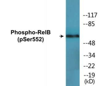 Western blot analysis of extracts from LOVO cells and RAW264.7 cells, using RelB (Phospho-Ser552) Antibody.