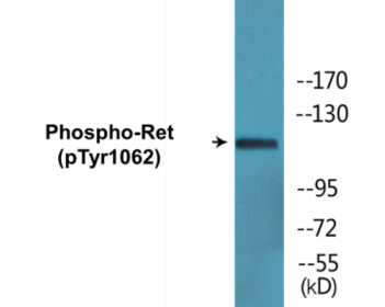 Western blot analysis of extracts from K562 cells, using Ret (Phospho-Tyr1062) Antibody.