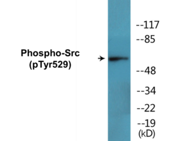 Western blot analysis of extracts from COS7 cells treated with PMA 125ng/ml 30', using Src (Phospho-Tyr529) Antibody.