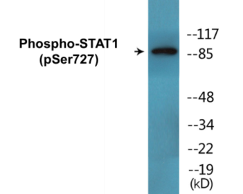 Western blot analysis of extracts from 293 cells, 3T3 cells treated with UV (15mins) and Jurkat cells treated with eto (25uM, 24hours), using STAT1 (Phospho-Ser727) Antibody.