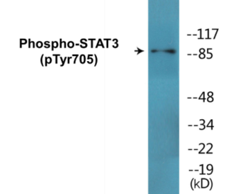 Western blot analysis of extracts from HeLa cells, using STAT3 (Phospho-Tyr705) Antibody.