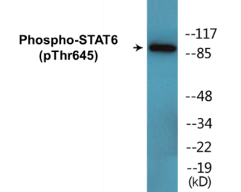 Western blot analysis of extracts from HeLa cells treated with EGF, using STAT5A (Phospho-Tyr694) Antibody.