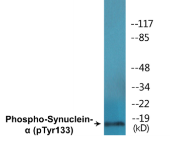 Western blot analysis of extracts from 293 cells treated with Etoposide 25 muM 60', using Synuclein-alpha (Phospho-Tyr133) Antibody.