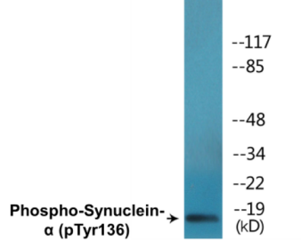 Western blot analysis of extracts from mouse brain, using Synuclein-alpha (Phospho-Tyr136) Antibody.
