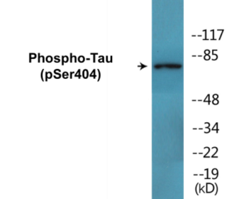 Western blot analysis of extracts from 293 cells treated with UV, using Tau (Phospho-Ser404) Antibody.