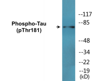 Western blot analysis of extracts from mouse brain, using Tau (Phospho-Thr181) Antibody.