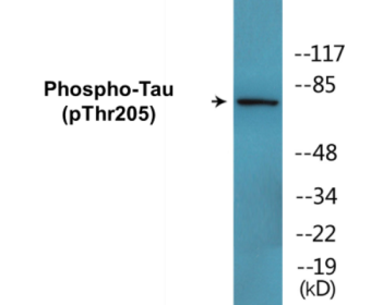 Western blot analysis of extracts from K562 cells and 293 cells, using Tau (Phospho-Thr205) Antibody.