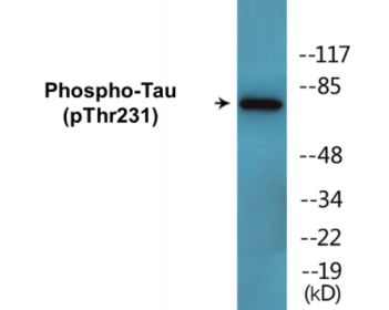 Western blot analysis of extracts from MDA-MB-435 cells, using Tau (Phospho-Thr231) Antibody.