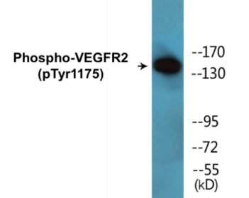 Western blot analysis of extracts from HuvEc cells and NIH/3T3 cells, using VEGFR2 (Phospho-Tyr1175) Antibody.