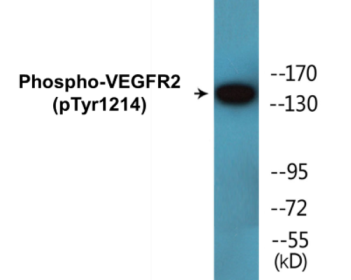 Western blot analysis of extracts from HepG2 cells treated with Na3VO4 0.3nM 40', using VEGFR2 (Phospho-Tyr1214) Antibody.