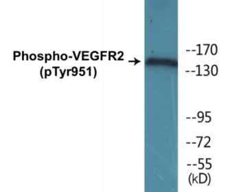 Western blot analysis of extracts from SK-OV3 cells, using VEGFR2 (Phospho-Tyr951) Antibody.