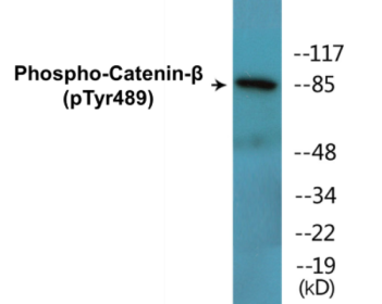 Western blot analysis of extracts from COS7 cells treated with UV 15', using Catenin-beta (Phospho-Tyr489) Antibody.