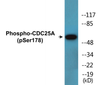 Western blot analysis of extracts from A549 cells treated with UV 15', using CDC25A (Phospho-Ser178) Antibody.