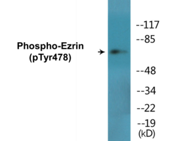 Western blot analysis of extracts from K562 cells treated with Na3VO4 0.3nM 40', using Ezrin (Phospho-Tyr478) Antibody.